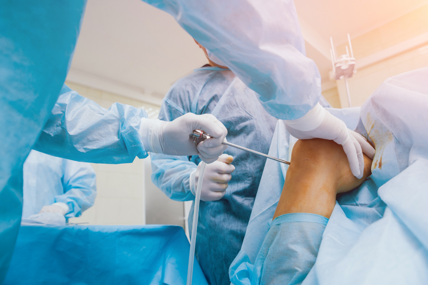 Arthroscopy and ACL Surgery: Causes, Treatment, and Recovery Guide