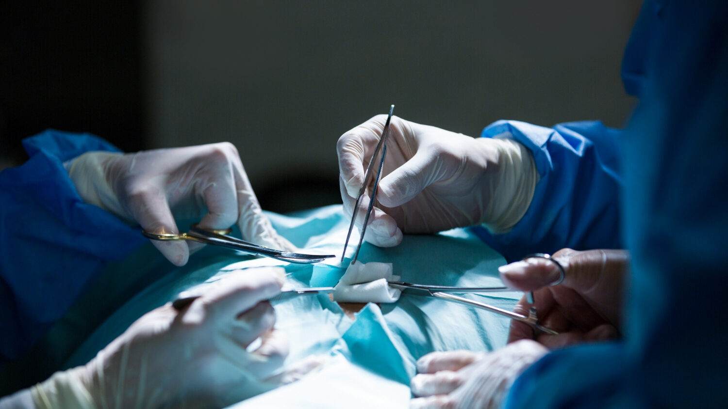 Total Hip Replacement (THR) for AVN Hip – Procedure & Benefits