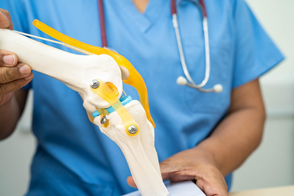 Knee Replacement