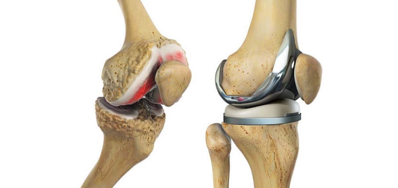 A close-up of a knee joint

Description automatically generated